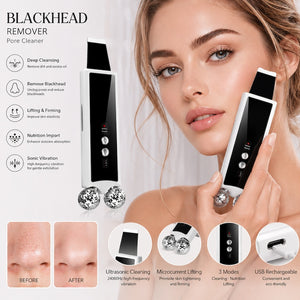 Stainless Steel Blackhead Remover Ultrasonic Facial Beauty Device