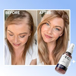 Hair Growth Spray ( Feg plus )
